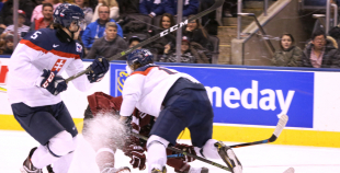 Latvija U20 - Slovākija U20 2:4